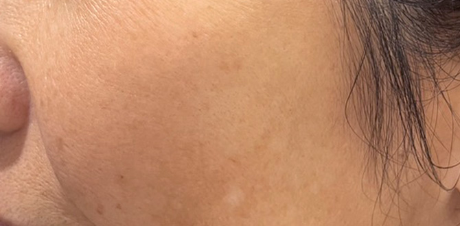 症例写真1アフター