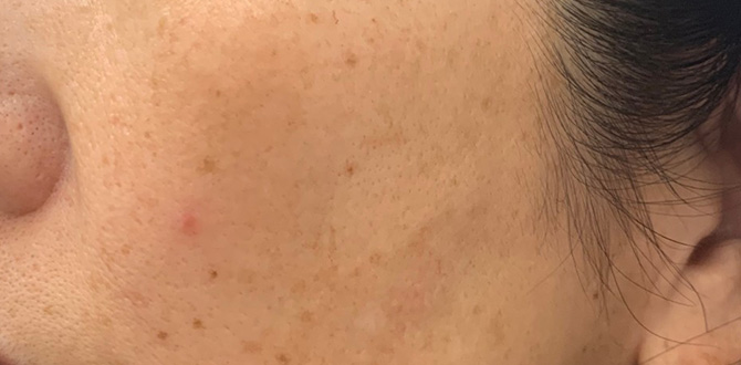 症例写真1ビフォー