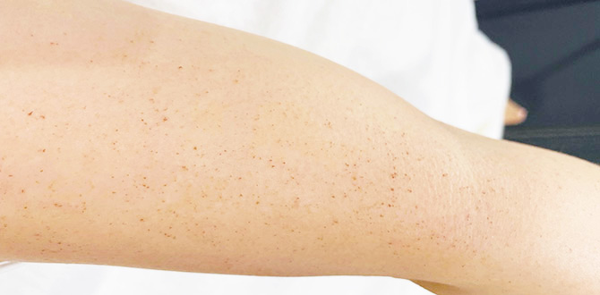 症例写真1ビフォー