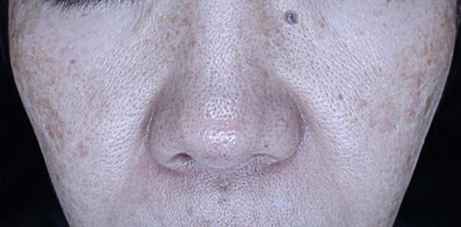 症例写真1アフター