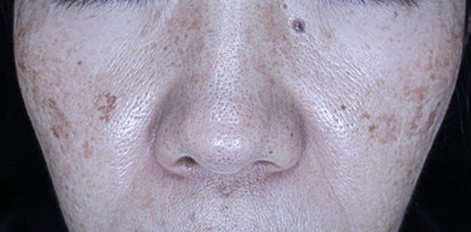 症例写真1ビフォー