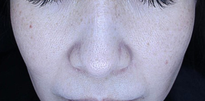 症例写真4アフター