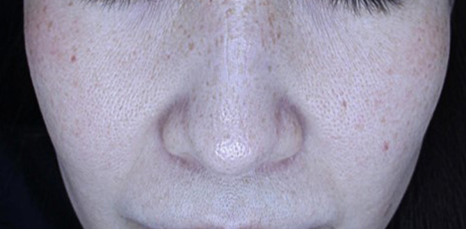 症例写真4ビフォー