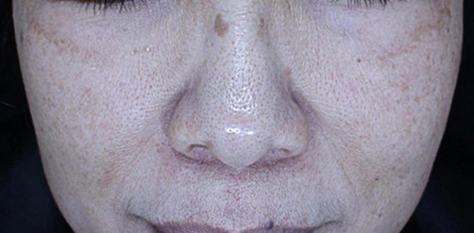 症例写真4アフター