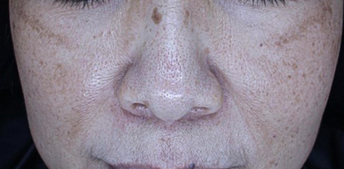 症例写真4ビフォー